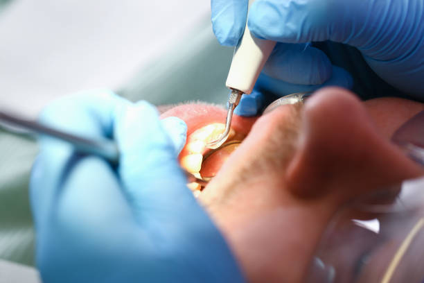 Best Emergency Dental Care for Broken or Chipped Teeth in Wyoming, MN