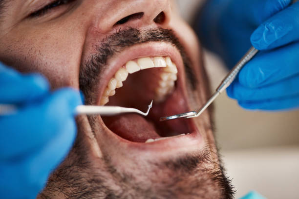 Best Emergency Denture Repair in Wyoming, MN